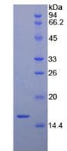 Rat BDNF Protein (Recombinant His, N-Terminal)