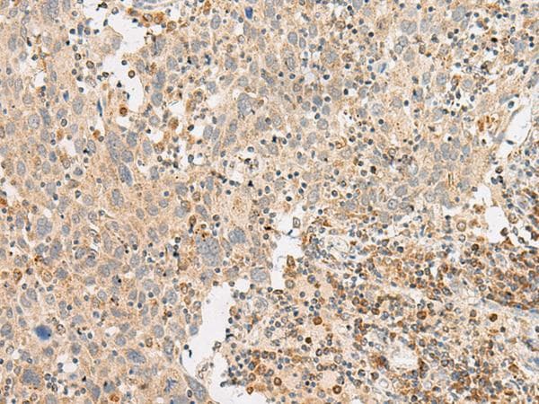 GPR119 Antibody