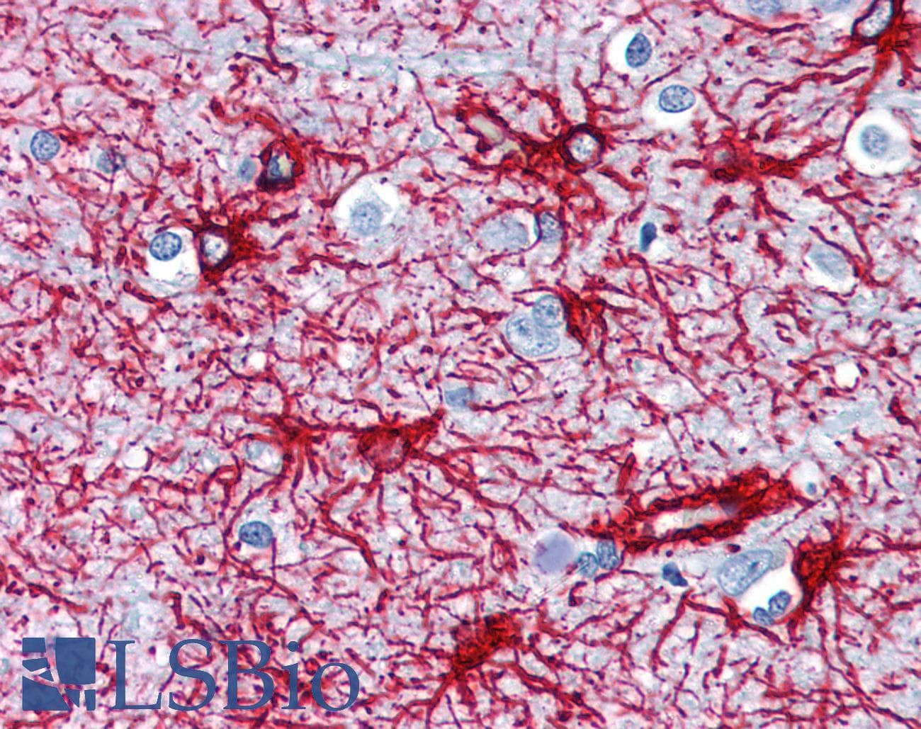 IHC-plus™ GFAP Antibody