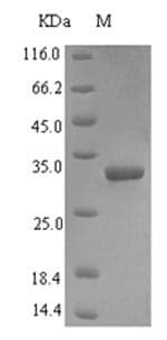 Human VPS13A / Chorein Protein (Recombinant 6His-SUMO, N-terminus)