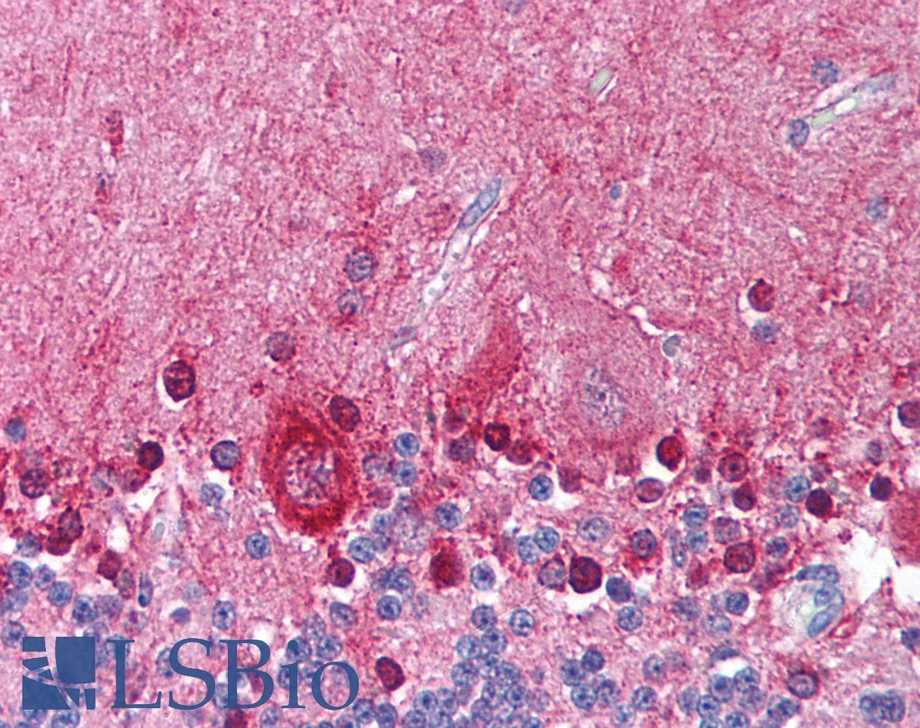 IHC-plus™ KCNMA1 / BK Antibody (Internal)