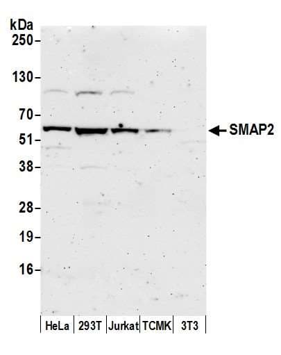 Polyclonal Rabbit anti-Human SMAP2 Antibody (aa379-429, WB)