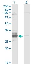 Monoclonal Mouse anti-Human TFPI2 Antibody (clone 3E8, IHC, WB)