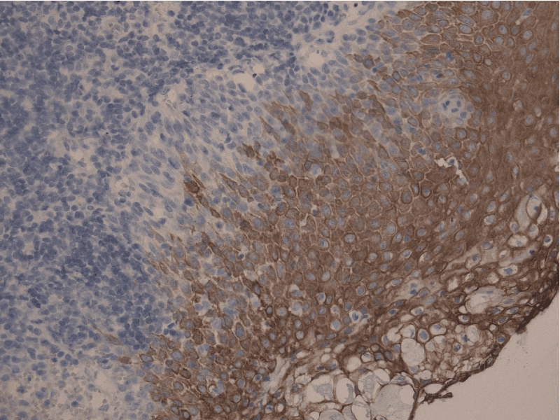 Monoclonal Mouse anti-Human Cytokeratin 10+13 Antibody (clone DE-K13, IHC, WB)