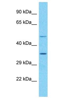 OR52E6 Antibody (aa257-306)