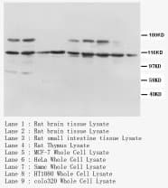 NTRK1 / TrkA Antibody (Internal)