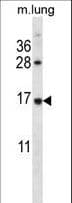 RPL27 / Ribosomal Protein L27 Antibody (aa91-120)