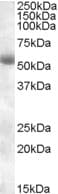 TMPRSS2 / Epitheliasin Antibody (Internal Region)