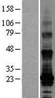 TM4SF19 Protein (Over-Expression Lysate Myc-DDK (Flag))