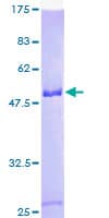 Human SNRP70 / SNRNP70 Protein (Recombinant GST)