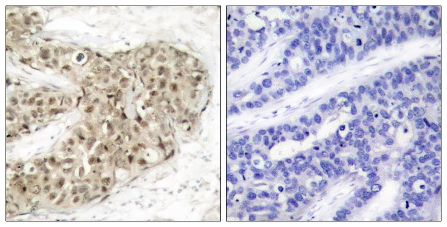 CDC25C Antibody (phospho-Ser216)