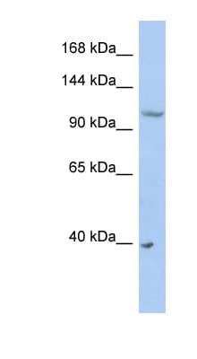 Polyclonal Rabbit anti-Human NEDD4L / NEDD4-2 Antibody (aa431-480, WB)