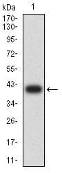 BCL10 / BCL-10 Antibody (clone 3C11F4)