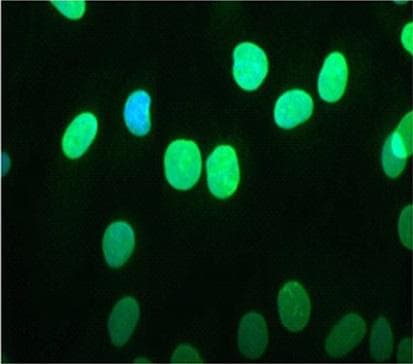 EMD / Emerin Antibody (clone MANEM1(5D10))