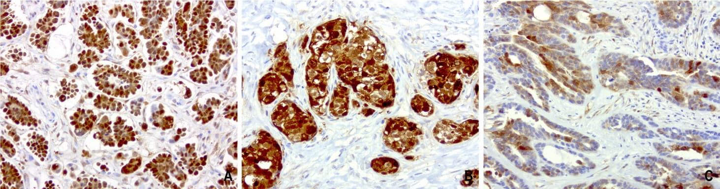 CRABP2 Antibody (clone UMAB176)