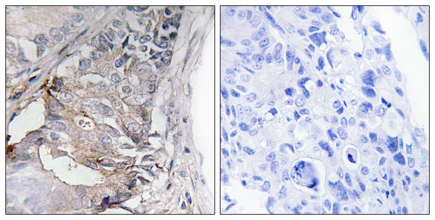 Polyclonal Rabbit anti-Human PDGFRB / PDGFR Beta Antibody (phospho-Tyr740, IHC, WB)