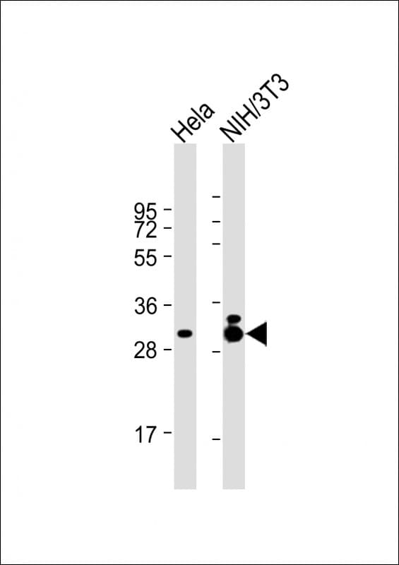 TPM3 Antibody (clone 1649CT306.29.13)