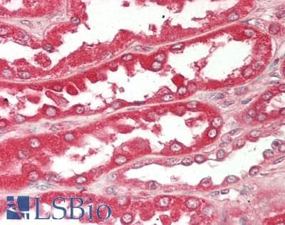 IHC-plus™ RAB7A / RAB7 Antibody (C-Terminus)