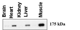 Polyclonal Rabbit anti-Human AGL Antibody (aa1479-1510, IF, WB)
