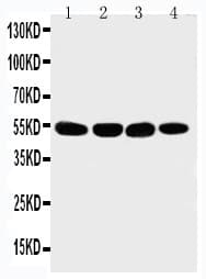 MATN3 / Matrilin 3 Antibody (aa466-486)
