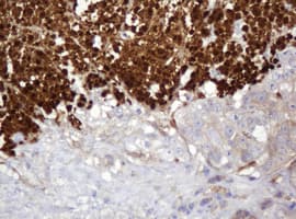 PARVB Antibody (clone OTI1B7)