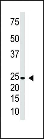 IFNL1 / IL29 Antibody (aa54-85)