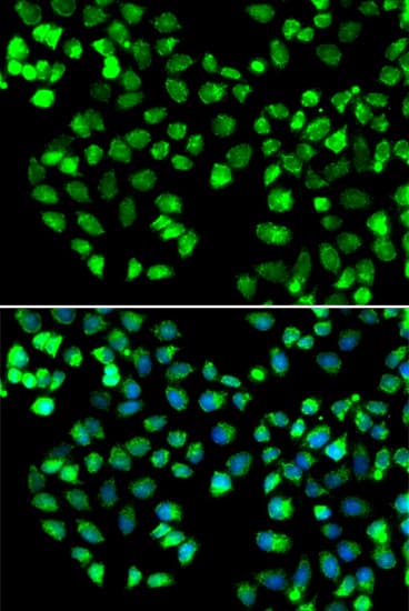 GRM4 / MGLUR4 Antibody
