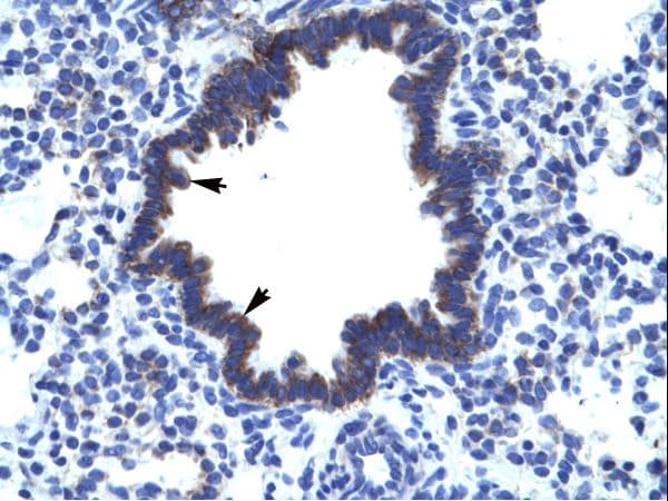 CHST4 / GlcNAc6ST2 Antibody (aa156-205)
