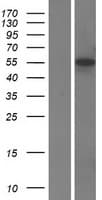 IRF5 Protein (Over-Expression Lysate Myc-DDK (Flag))