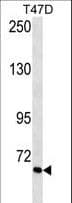 Monoclonal Mouse anti-Human VTN / Vitronectin Antibody (aa352-379, WB)