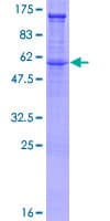 Human SDC2 / Syndecan 2 Protein (Recombinant GST)