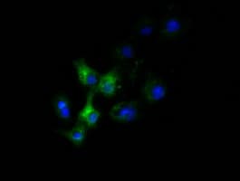 SLC30A3 / ZNT3 Antibody (clone OTI2H6)