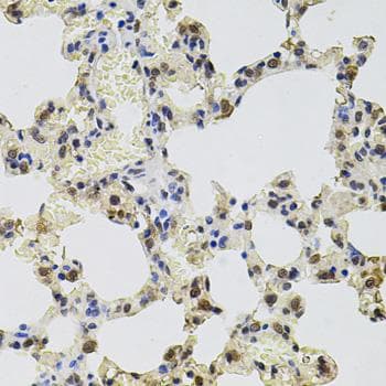 GTF2H2 Antibody