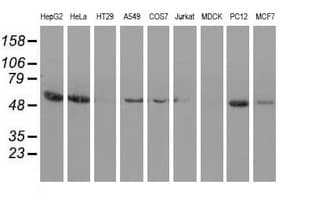 SNTA1 / Syntrophin Alpha 1 Antibody (clone OTI2B9)