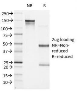 BCL6 Antibody (clone BCL6/1527)