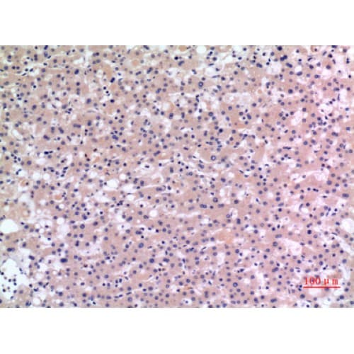 CMTM6 / CKLFSF6 Antibody (131-180 aa, C-terminal)