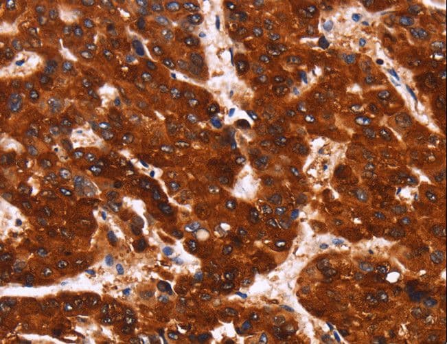 ADGRA2 / GPR124 Antibody