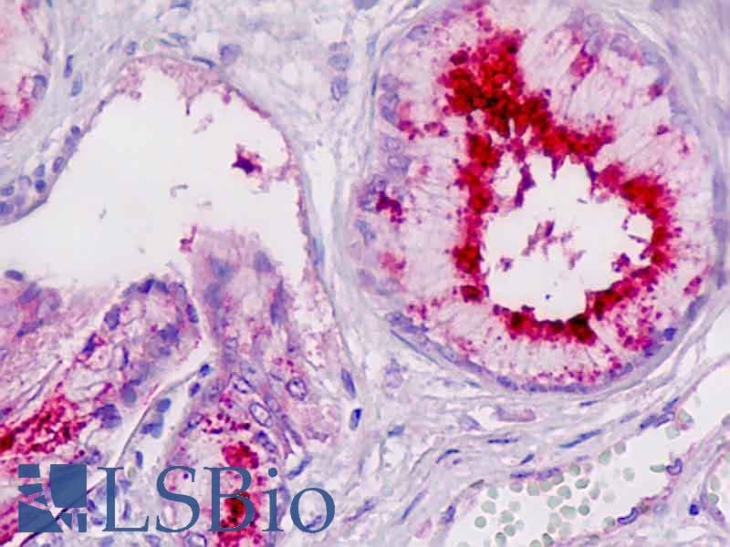 IHC-plus™ Polyclonal Rabbit anti-Human LP-PLA2 / PLA2G7 Antibody (IHC, WB)