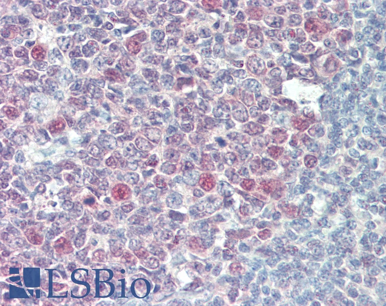 IHC-plus™ PRMT4 / CARM1 Antibody (aa550-C-term)