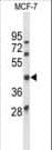 ATXN3 / JOS Antibody (aa261-288)
