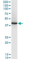 RNF2 / RING2 / RING1B Antibody (clone 3G6)