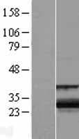 ZCCHC24 Protein (Over-Expression Lysate Myc-DDK (Flag))