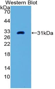 PLAP / Alkaline Phosphatase Antibody (aa68-313)