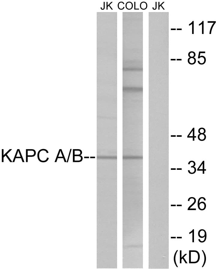 PRKACA + PRKACB Antibody