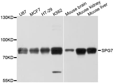 Polyclonal Rabbit anti-Human Paraplegin / SPG7 Antibody (WB)