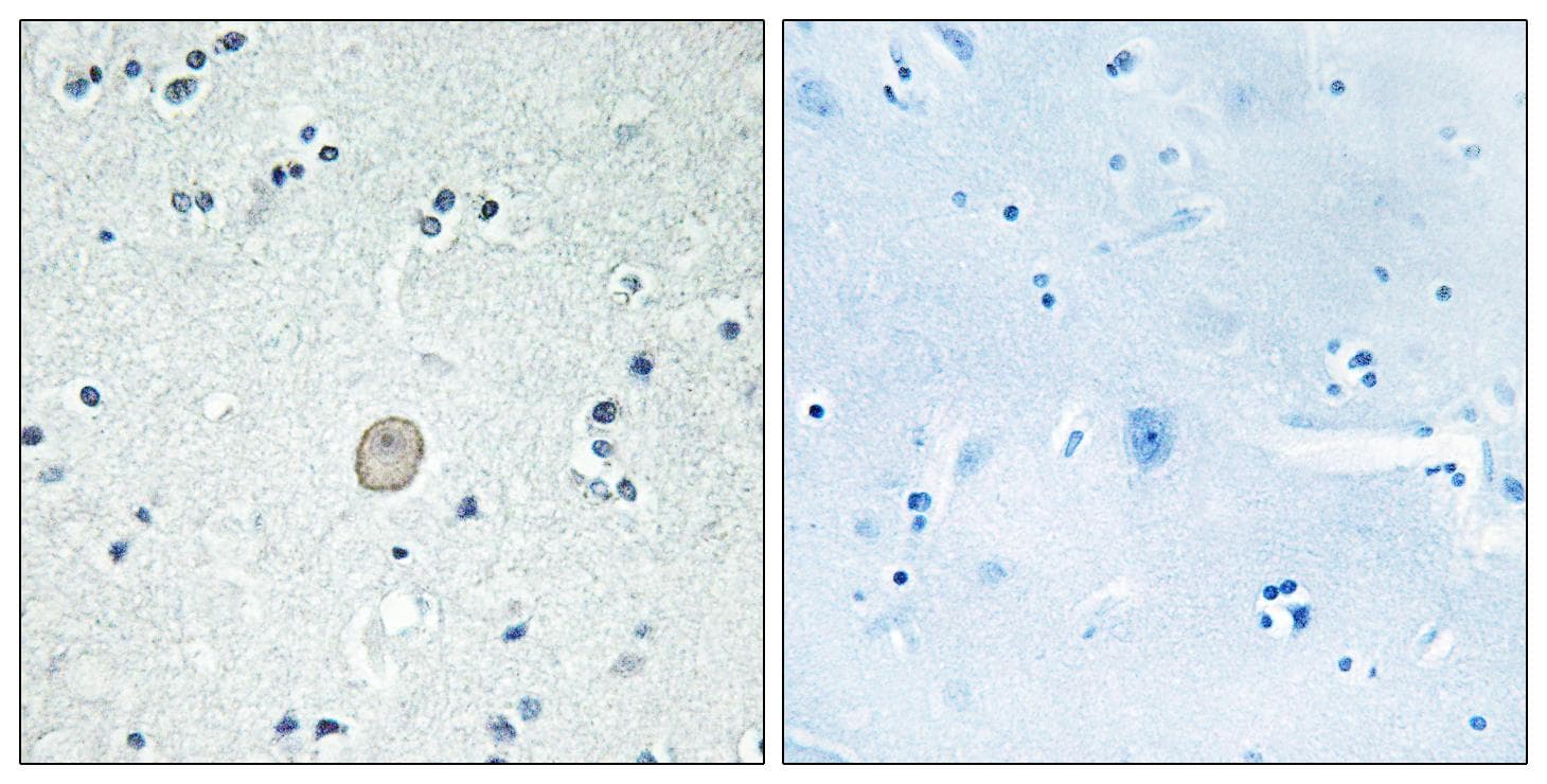 C3AR / C3a Receptor Antibody