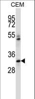 IBSP / Bone Sialoprotein Antibody (aa70-99)