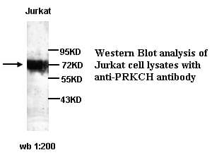 Polyclonal Rabbit anti-Human PRKCH / PKC-Eta Antibody (WB)