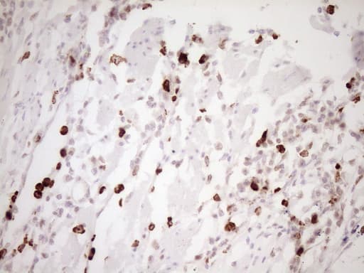 Monoclonal Mouse anti-Human TFPI / LACI Antibody (clone OTI5H5, Carrier-free, aa29-304, IHC, WB)