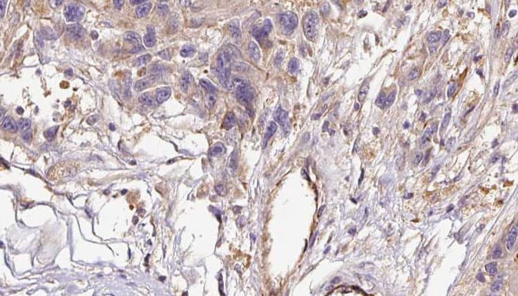 COL6A1 / Collagen VI Alpha 1 Antibody